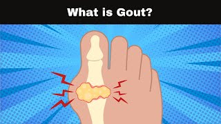 What is Gout?