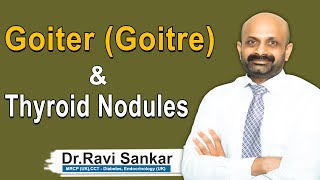 Goiter (Goitre) & Thyroid Nodules | Dr. Ravi Sankar Erukulapati, Senior Endocrinologist