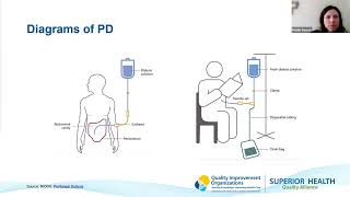 Managing Nursing Home Residents Receiving Dialysis (Roundtable)