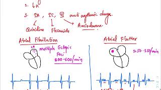 Most important ECG’s to learn ( made easy ) |part3