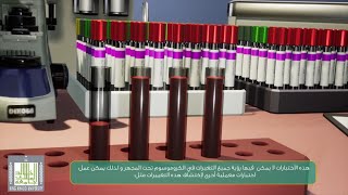 04 اختبارات الوراثية الخلوية لسرطان الدم النقوي الحاد   - Cytogenetic of AML