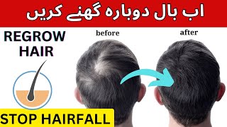 Stop HAIRFALL & Regrow Hair | 3 Nutrients To Grow Hair Fast 100% | لمبے گھنے بال کا اصل طریقہ