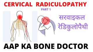 CERVICAL RADICULOPATHY - PART 1 - EPISODE 4