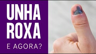 UNHA ROXA, o que devo fazer? Por Dr. Luiz Gameiro, dermatologista