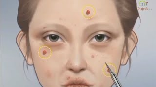 How to remove face pimples how to clean face black #facewarts #makuep #mrnajeebideas