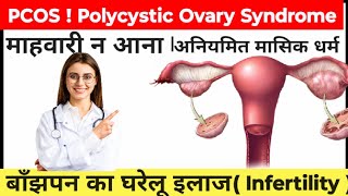 Polycystic Ovary Syndrome (PCOS)। PCOS क कारण लक्षण व घरेलू इलाज। irregular period। मासिक धर्म।