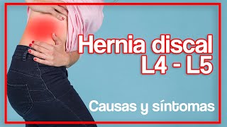 Causas y Síntomas de: Hernia discal L4 - L5