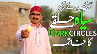 Ankhon Ke Gird Siyah Halke آنکھوں کے نیچے سیاہ حلقے (Dark Circles Under Eyes) Khatam Karne Ka Tarika