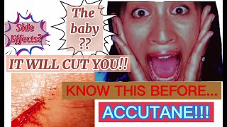 6 BIGGEST risks to the body... ACCUTANE secrets to be aware of considering before going on the drug