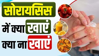 सोरायसिस को रोकने के लिए क्या खाएं क्या न खाएं  | Diet | Foods Not To Eat When You Have Psoriasis