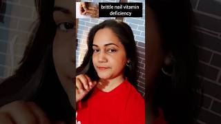 Brittle Nail Vitamin Deficiency #ytshorts #shorts