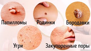 8 Серьезных Заболеваний, о Которых Говорит Наша Кожа