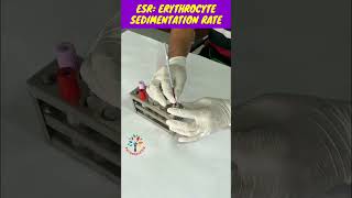 ESR Practical ll ESR viral shorts