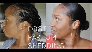 Postpartum Shedding on Natural Hair: How to Survive