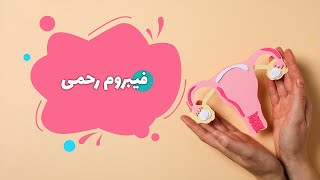 فیبروم رحمی