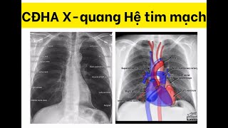 CĐHA X-quang hệ tim mạch - TS. BS Hoàng Đình Âu