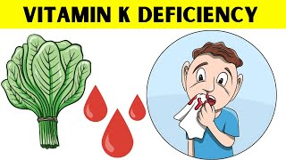 The Surprising Truth About Vitamin K Nobody Tells You