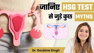 जानिए HSG Test से जुड़े कुछ Myths | Myths related to HSG Test | Dr. Reubina Singh