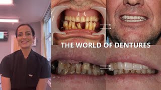 Let's Delve Into The World Of Dentures