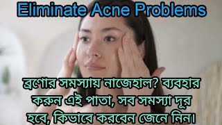 Eliminate Acne Problems /ব্রণোর সমস্যা দূর করতে অব্যর্থ এই পাতা, কিভাবে ব্যবহার করবেন জেনে নিন।