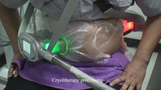 Part 3 Cryoltherapy processing