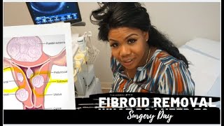 Fibroid Removal-Trying To Conceive Over 40 W/Dr. Patel @ Fort Worth Fertility Center Part 3