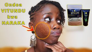 Ondoa VITUNDU USONI haraka na MASK hii | How to get rid of large pores fast