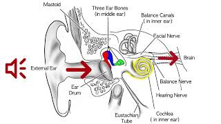 What is an Acoustic Neuroma?