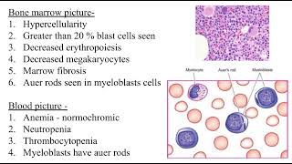 Acute myeloid leukaemia | pathology mbbs 2nd year