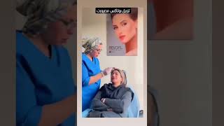 تزریق بوتاکس مصپورت زیباجو عزیز #botox  #بوتاکس #تزریق_بوتاکس #جوانسازی_صورت #جوانسازی_پوست #زیبایی