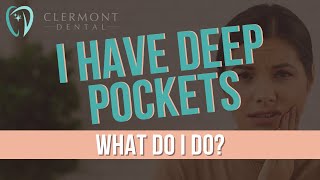 I HAVE DEEP POCKETS WHAT DO I DO? #OralHealth #DeepPockets #GumDisease #DentalCare