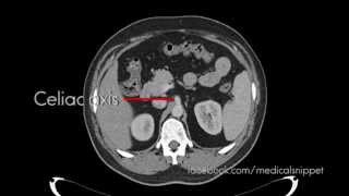 Branches of Celiac Axis