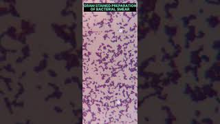 GRAM POSITIVE COCCI  UNDER 100X OBJECTIVE LENS #ultimatemlt #viralshorts #mlt