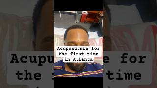 Acupuncture for energy Healing #selfcare #acupuncture #shorts #vlog