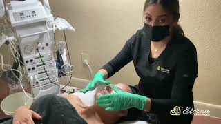 Diamond Tip Microdermabrasion