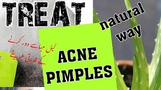 BEST TREATMENT FOR  ACNE/PIMPLES | TIPS AND REMEDIES |Dr. salma waqas | urdu,hindi,eng sub |