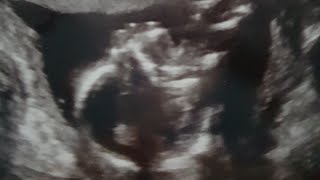 17 weeks pregnancy update & GENDER REVEAL!