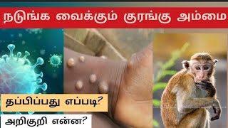 குரங்கு அம்மை அறிகுறி என்ன? Monkey pox symptoms