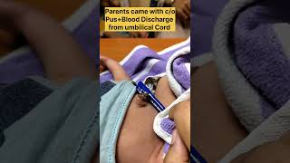 How to care umbilical cord at home#shorts #youtubeshorts #care