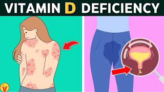 10 Warning Signs Your Body is Crying for Vitamin D | VisitJoy