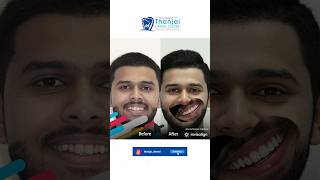 உங்க பற்களை அழகா straight align பண்ணனுமா? | Thanjai Dental centre #thanjavur #tamildentist