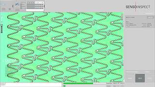 How to perform an automatic stent quality control?