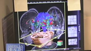 Advanced Brain Imaging Video