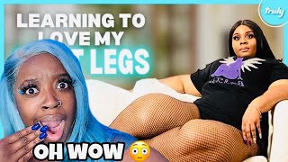 WOW !! I’ve Hidden My ‘Tree Trunk’ Legs - Until Today REACTION