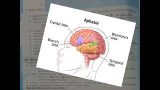 q. 229| brain ischemic injuries| rafiullah past papers|Fcps part-1 preparation forum|neurology