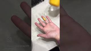 BEST TIP EVER! KITCHEN HACK! LIFE HACK! What to do if you have a burn!