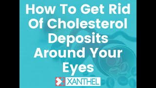 How To Get Rid Of Cholesterol Deposits Around Your Eyes  - By XANTHEL ®