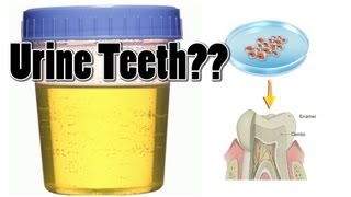 Scientists Grows "Teeth" From Urine