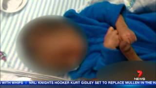 Heartbreaking decision on bashed baby