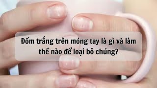 Đốm trắng trên móng tay là gì và làm thế nào để loại bỏ nó? | Báo Lao Động